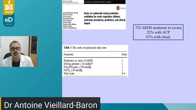 Hemodynamic monitoring A Vieillard