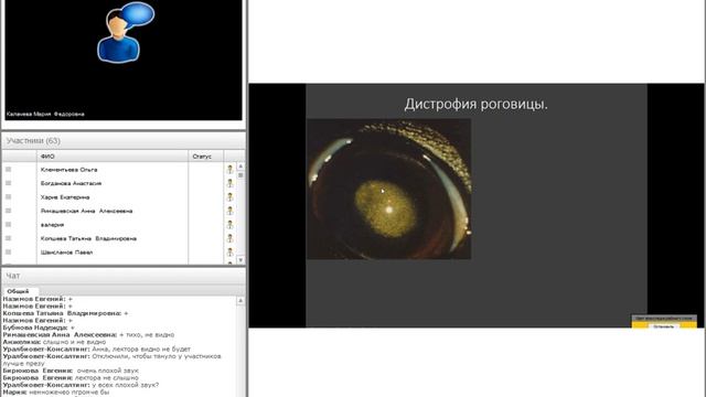 Синдром "белого глаза". Калачева Мария #убвк_офтальмология