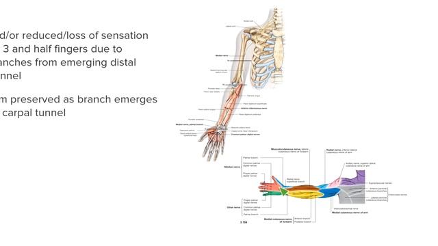 10. Nerve Lesion of Upper Limb
