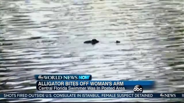 Alligator who bit woman's arm killed