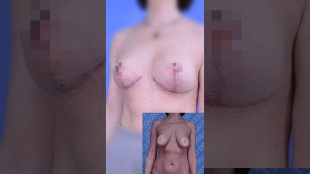 Сроки формирования результата
