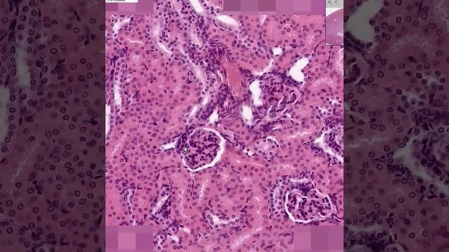 Shotgun Histology Kidney