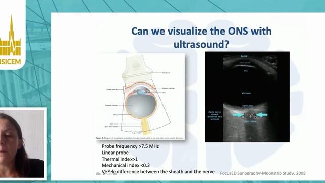 Rapid ultrasound for the brain in emergency settings Chiara Robba (ISICEM 2020)