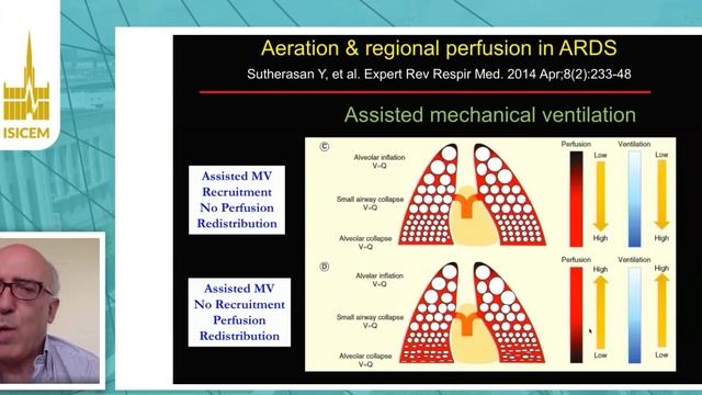 COVID-19 CT perfusion to assess aeration and perfusion  Paolo  Pelosi (ISICEM 2020)