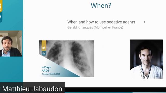 Inhaled sedation in ARDS M Jabaudon