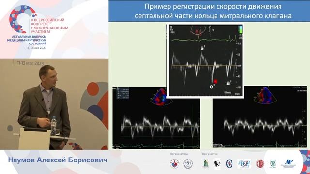 УЗИ оценка ХСН до операции Наумов АБ