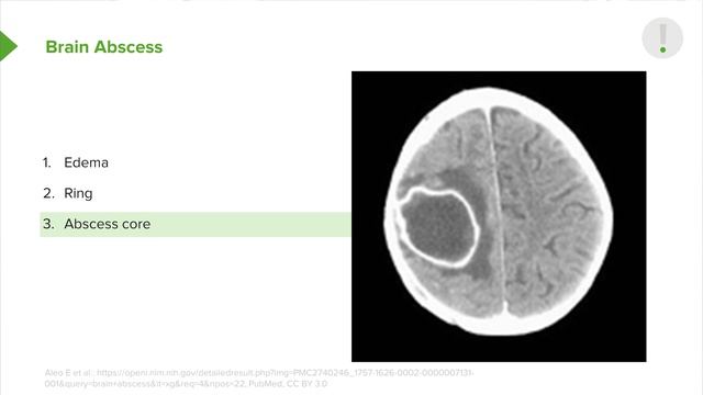 10. Brain Abscess and Encephalitis