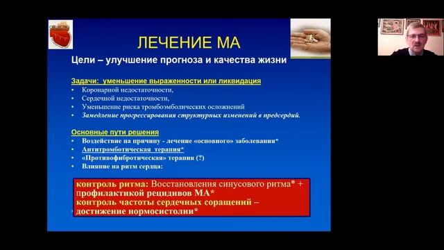 Нарушение ритма  Мерцательная аритмия 2020   Часть 2