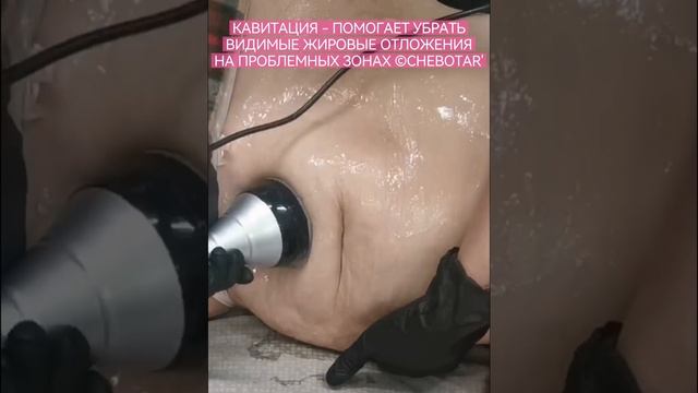 КАВИТАЦИЯ