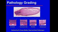 Medical Hyperspectral Imaging Artificial Intelligence and Image-Guided Surgery