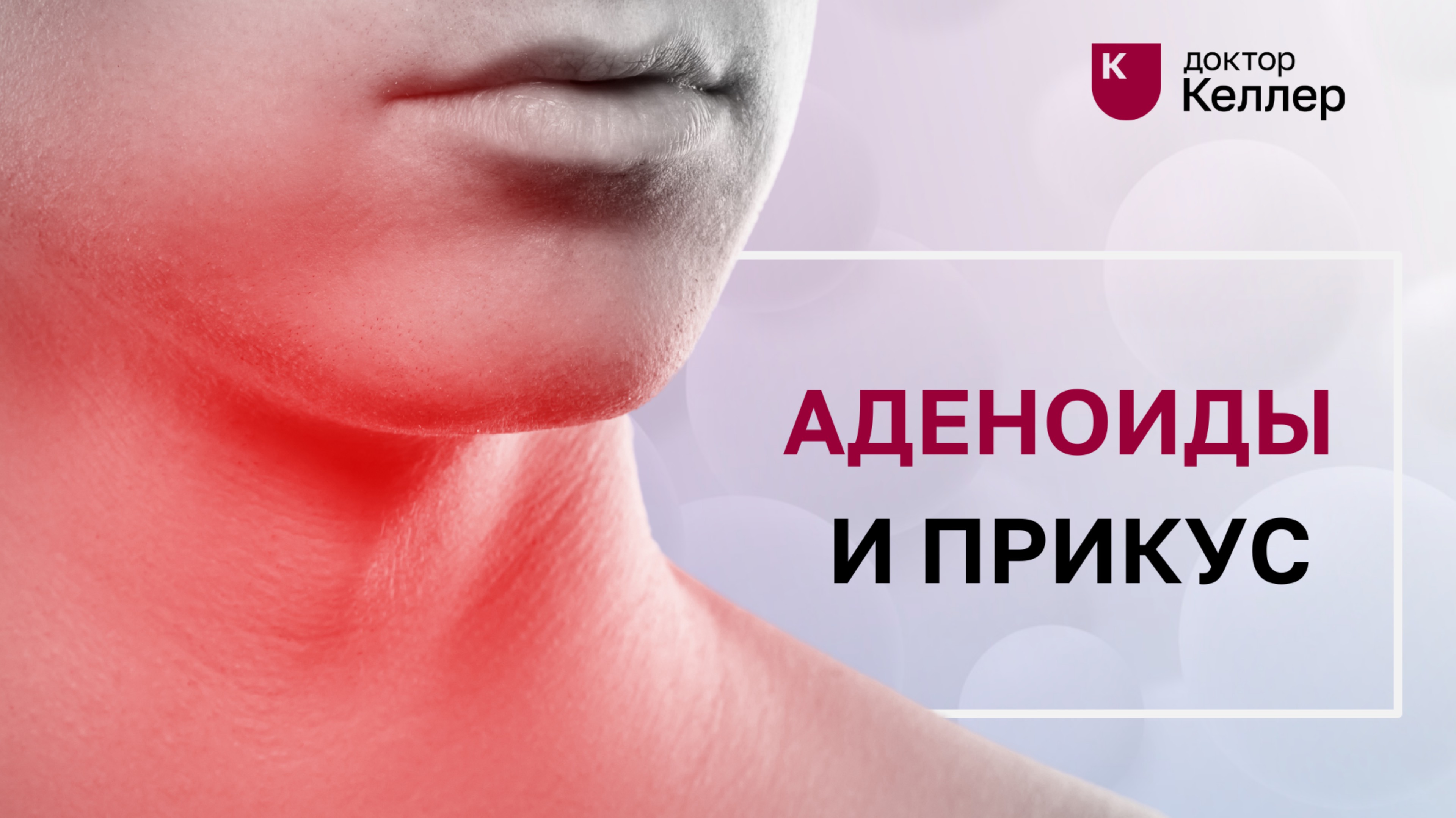 Аденоиды и прикус