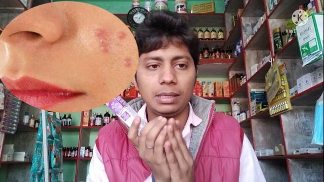 Boro plus cream ke fayde | boro plus cream in hindi | antiseptic cream | ayurvedic antiseptic cream