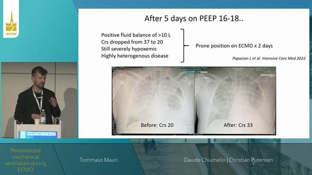 ECMO (ISICEM 2022)