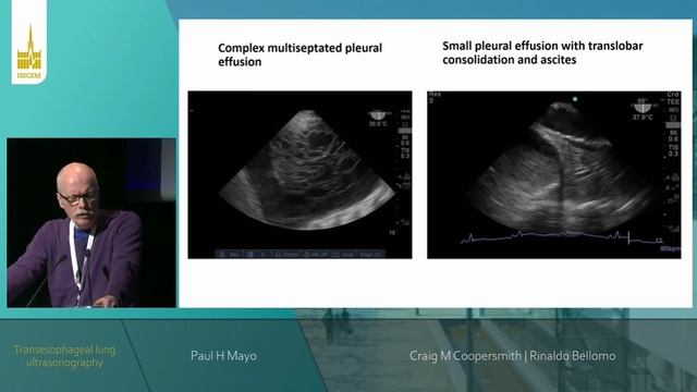 BEDSIDE ECHOGRAPHY (ISICEM 2022)