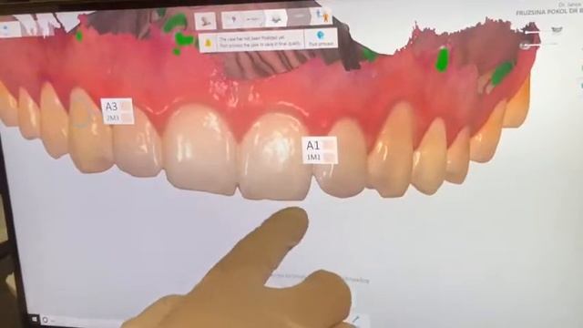Digitális Fogszín Meghatározás - Radian Digital Dental