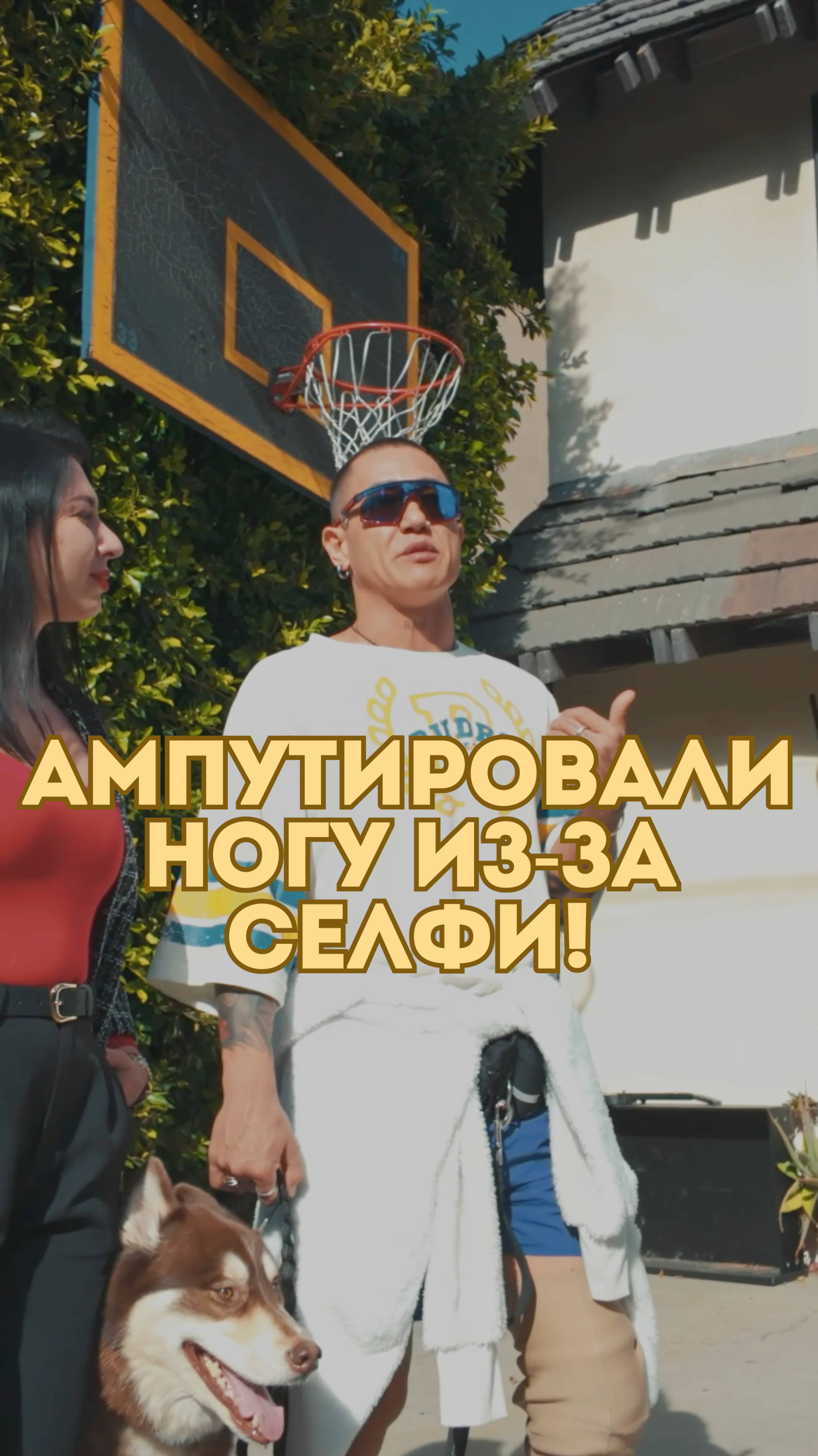 Ампутировали ногу из-за селфи! Kima Dima