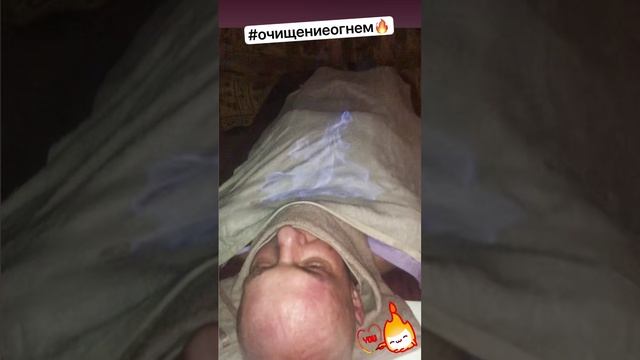 Массаж огнем и дорога из огня