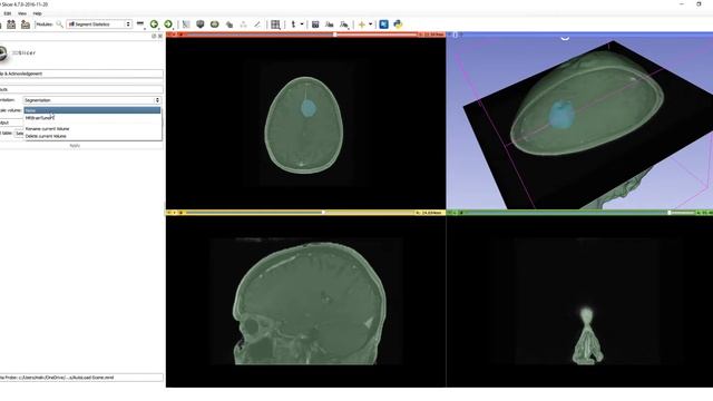 Segment statistics - new module in 3D Slicer