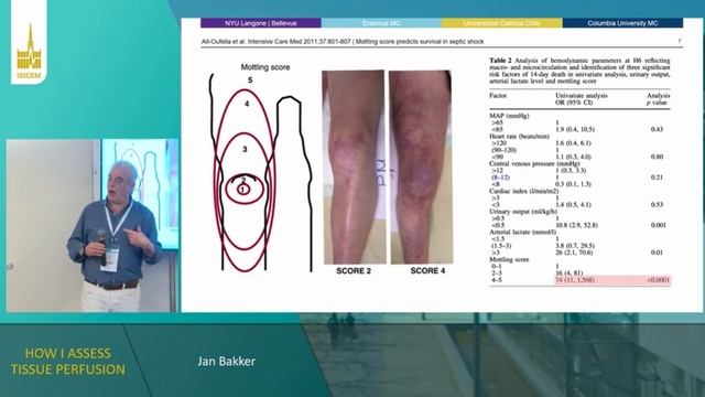 HOW I ASSESS TISSUE PERFUSION (ISICEM 2022)