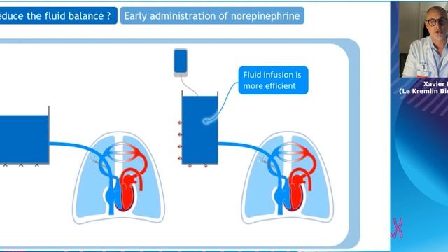 How can we reduce the fluid balance Xavier Monnet