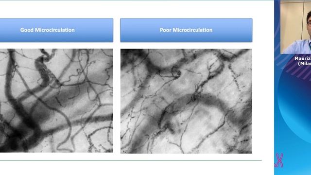 Tissue oxygenation Maurizio Cecconi (ESICM 2021)