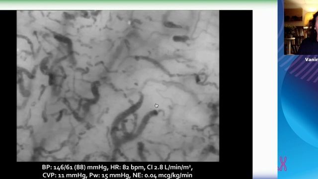 Microcirculation Vanina Edul (ESICM 2021)