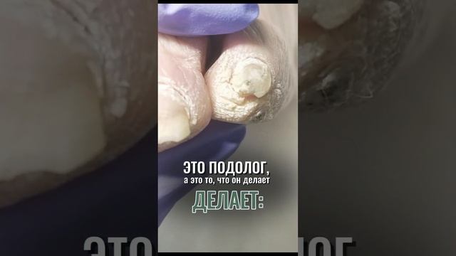 Чем занимается мастер подолог?