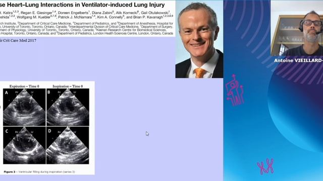 Heart-lung interactions Antoine Vieillard-Baron (ESICM 2021)