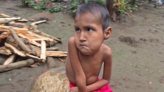 ME PARTE EL ALMA conocer a Alfonso un chico de 12 años que apenas camina POR FALTA DE COMIDA.