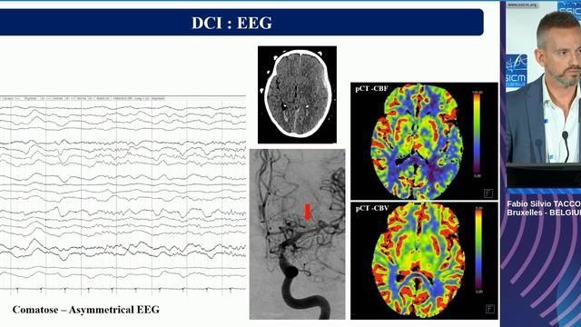 DCI How to monitor it and effect on outcome Fabio Silvio Taccone (ESICM 2023)