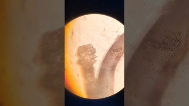 Микроскопия ресниц (клещ Demodex)