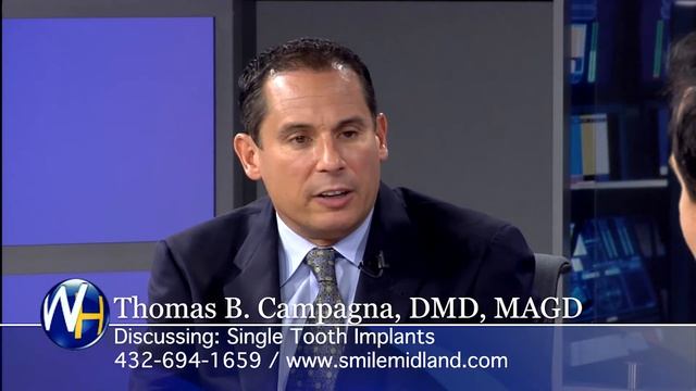 Single Tooth Mini-Dental Implants with Midland, TX dentist Dr. Thomas Campagna