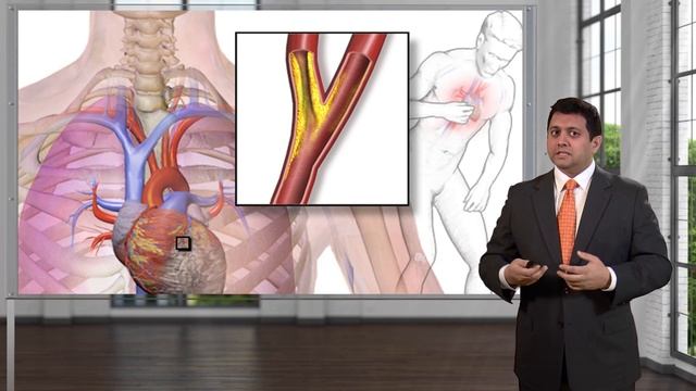 02.01 Introduction – Angina and Heart Failure Management