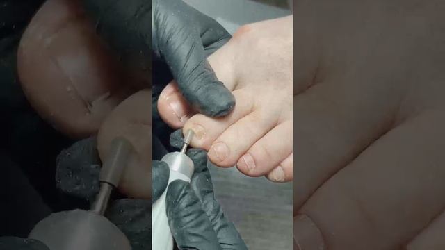 Педикюр в технике KANE ПАП c применением препаратов от KANE Professional