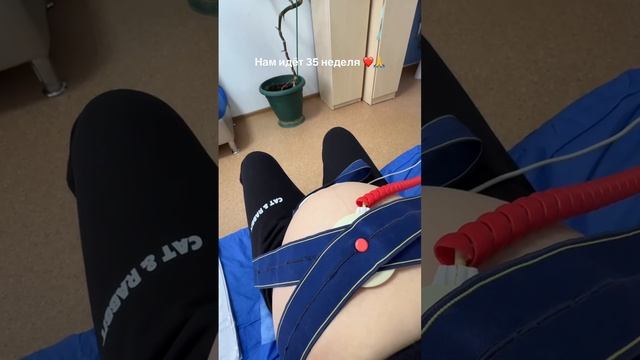 Первое КТГ Жемчуговых🙏