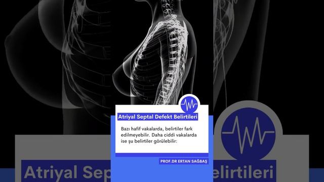 Atriyal Septal Defekt Belirtileri (ASD)