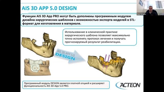 Обучение Acteon по цифровым ортопантомографам X-MIND Prime