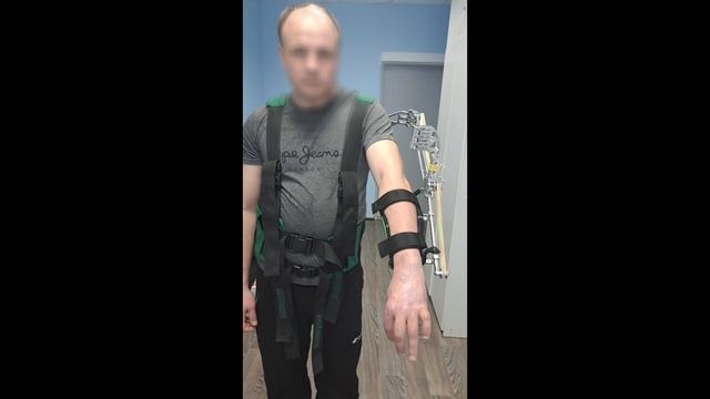 Рафаэль-Миопатия, Стационарная версия экзоскелета.
