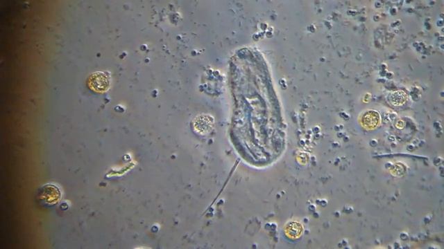 Possibly another worm thing, phase contrast, 400x