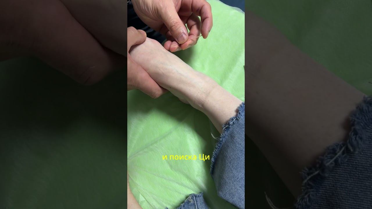 Семинар в Казани по иглоукалыванию