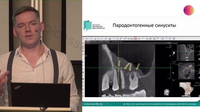 Курасов Д. Н. / Периодонто-пародонтальные поражения-2