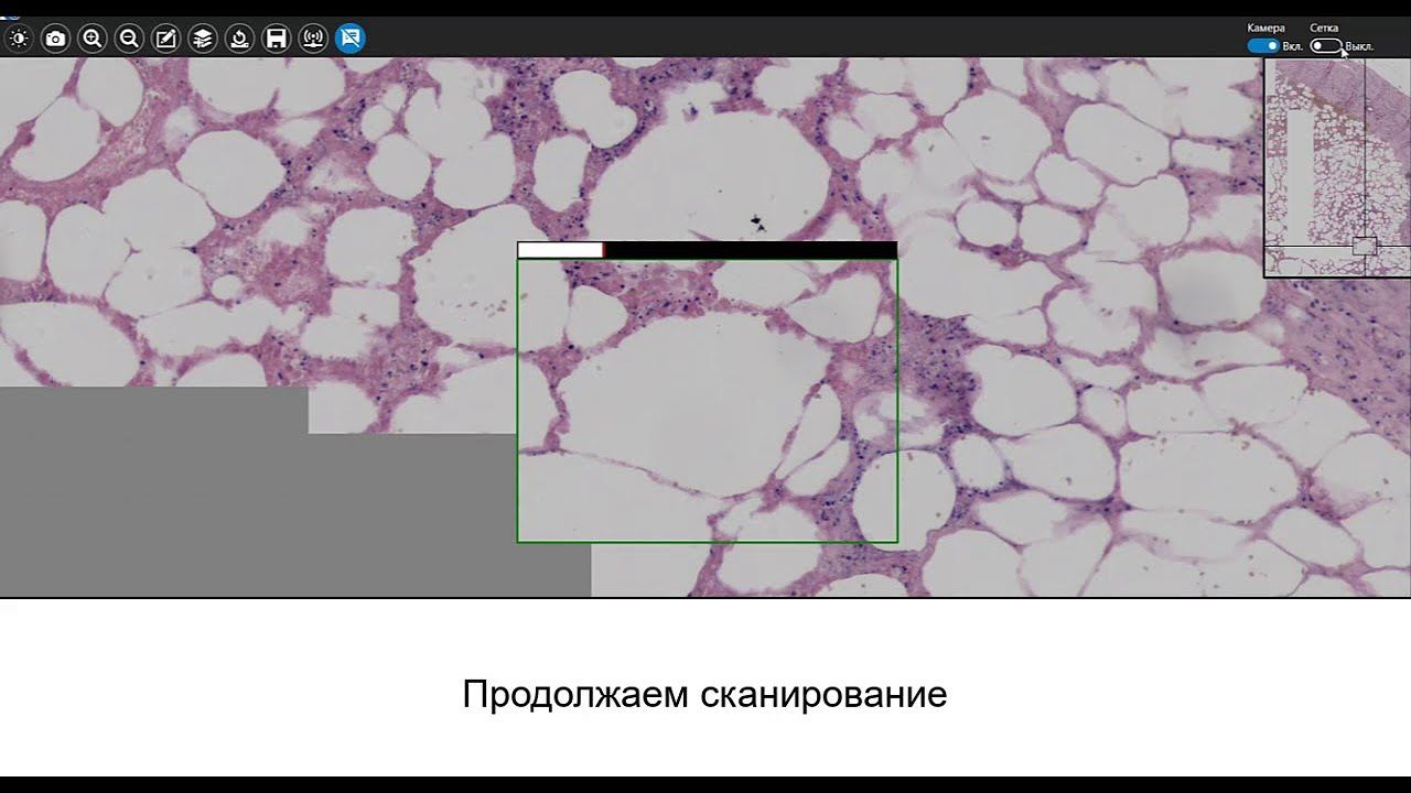 ММС Скан (MMC Scan) ПО для сканирования микропрепаратов