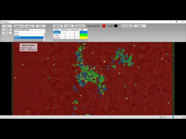 ММС МультиМетр: диагностика цилиарной дискинезии