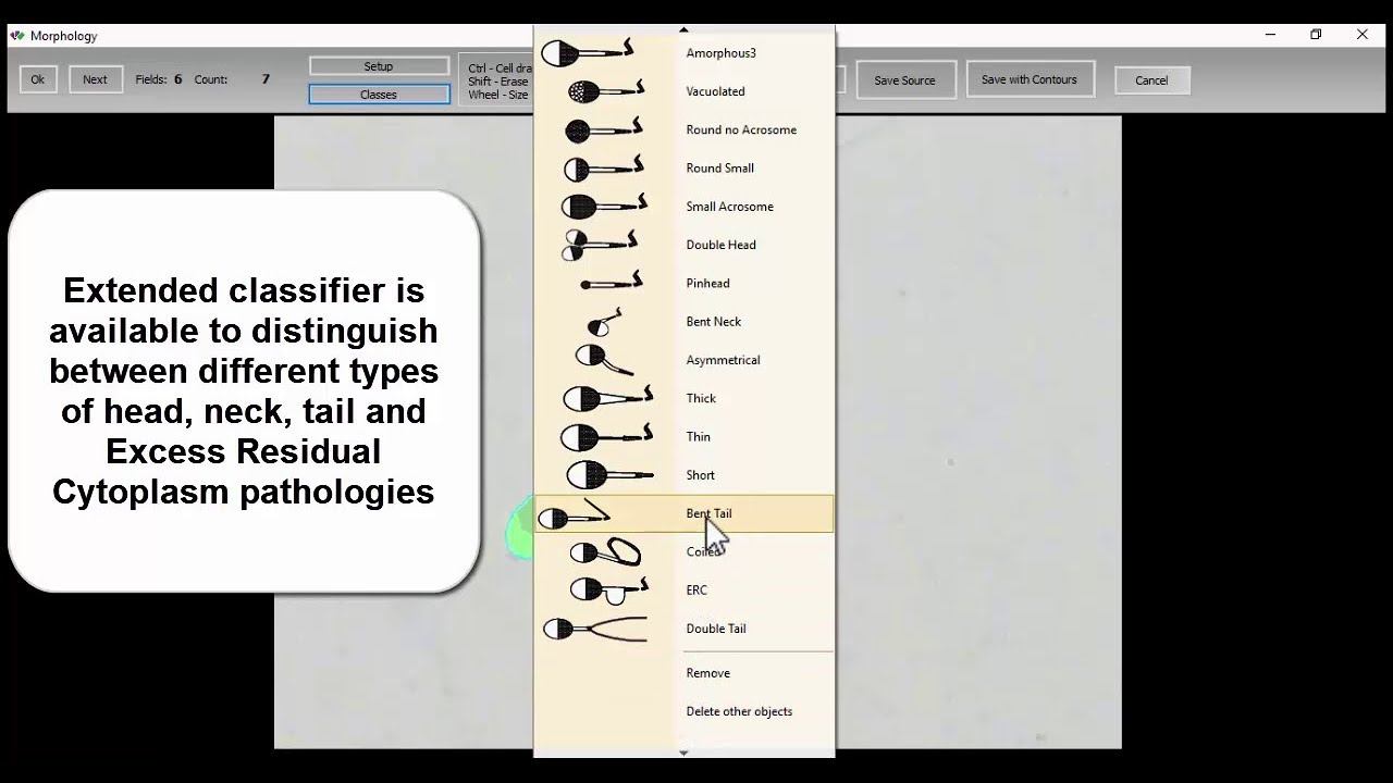 MMC Sperm: sperm morphology analysis