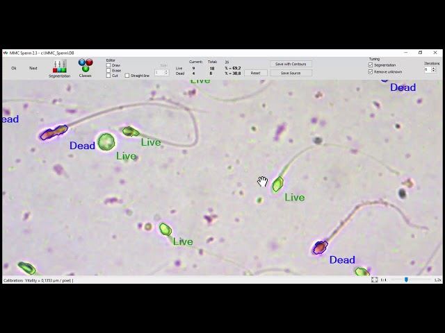 MMC Sperm: sperm vitality analysis