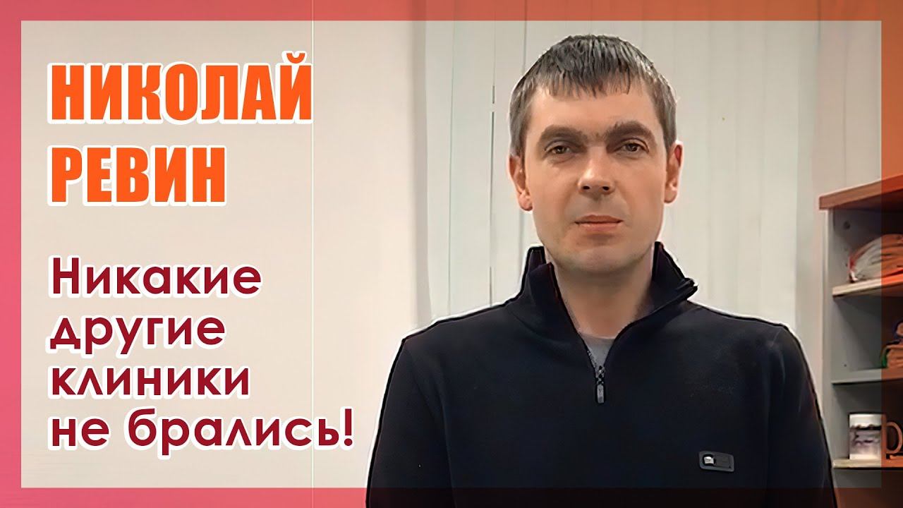 Дорзальная секвестрированная грыжа позвоночника. Отзыв пациента клиники Имбамед -  Николая Ревина.