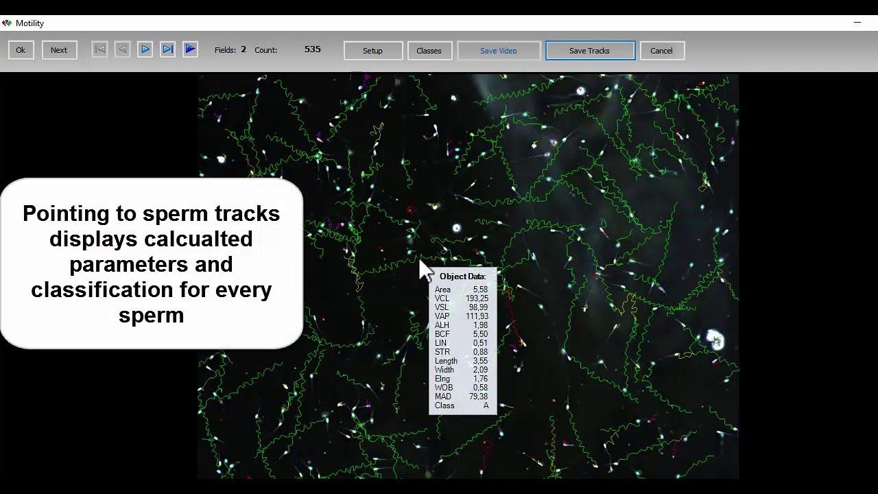 MMC Sperm: sperm motility analysis