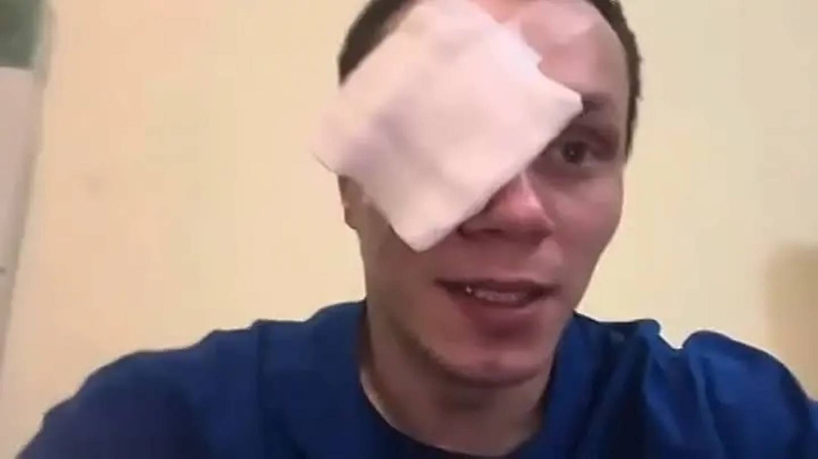 Боец поп-ММА Корней Тарасов лишился глаза после удара девушки