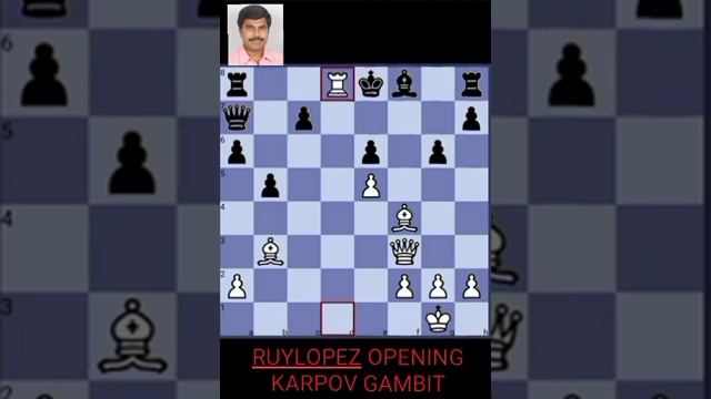 RUY LOPEZ OPENING KARPOV GAMBIT