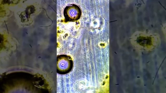 Sprite vs Germs Under Microscope #microbiology #science #microscope